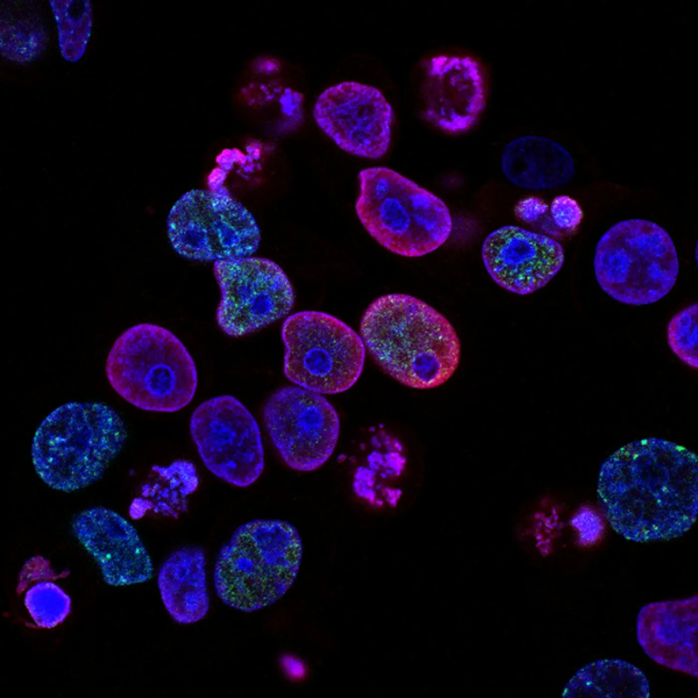 Microscopy and research